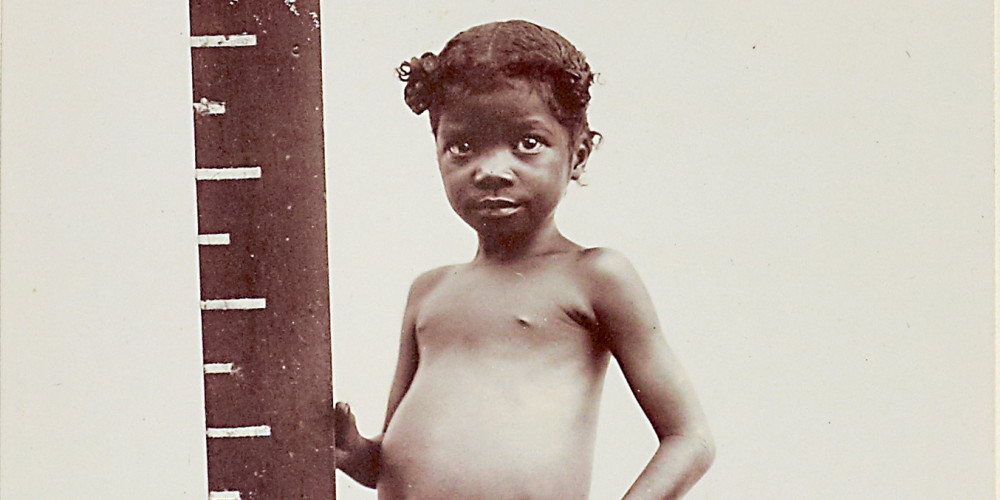 Portrait ethnographique d'une petite fille malgache
