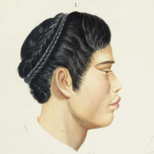 Frères siamois et femme de Calcutta